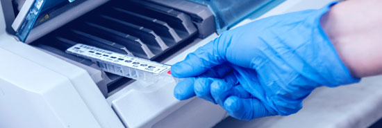 Master Bond Adhesives for Molecular Diagnostic Testing