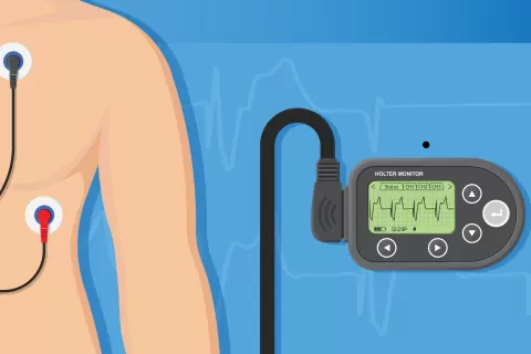 Medical Monitoring